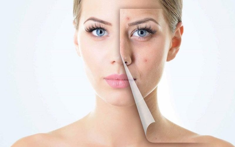 Dermatologija